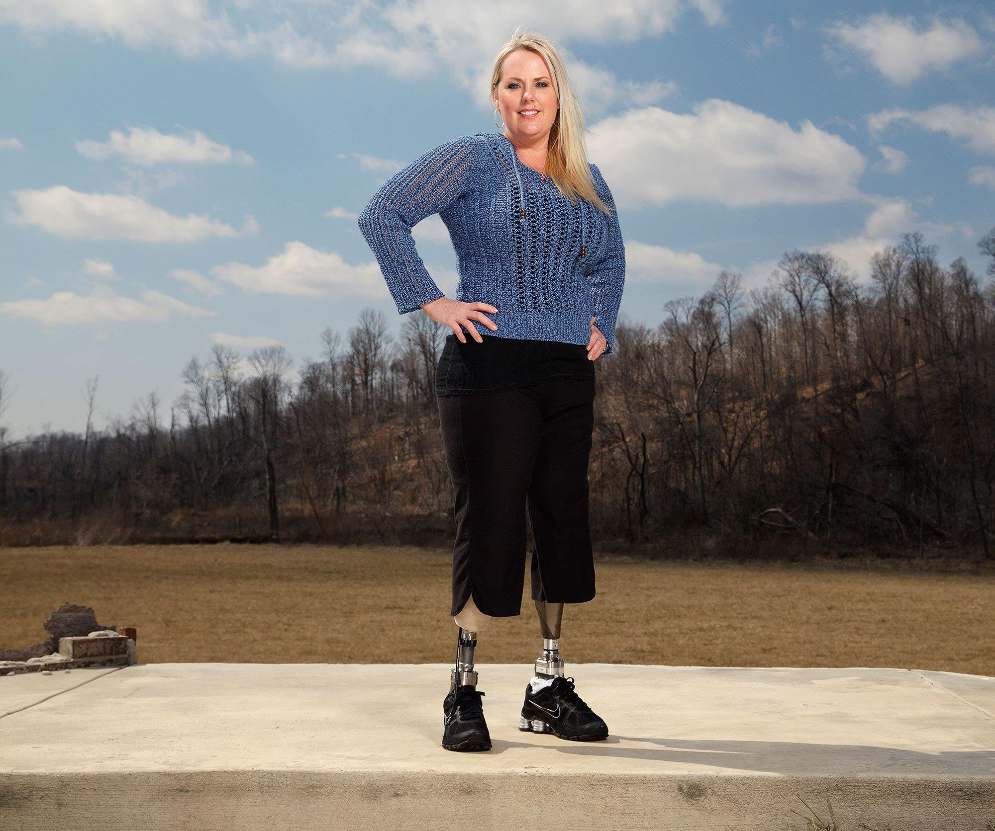 Stephanie Decker, Motivational Keynote Speaker And Double Amputee